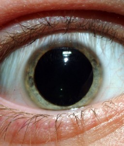 acid eye