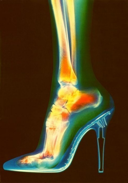 high heel x-ray