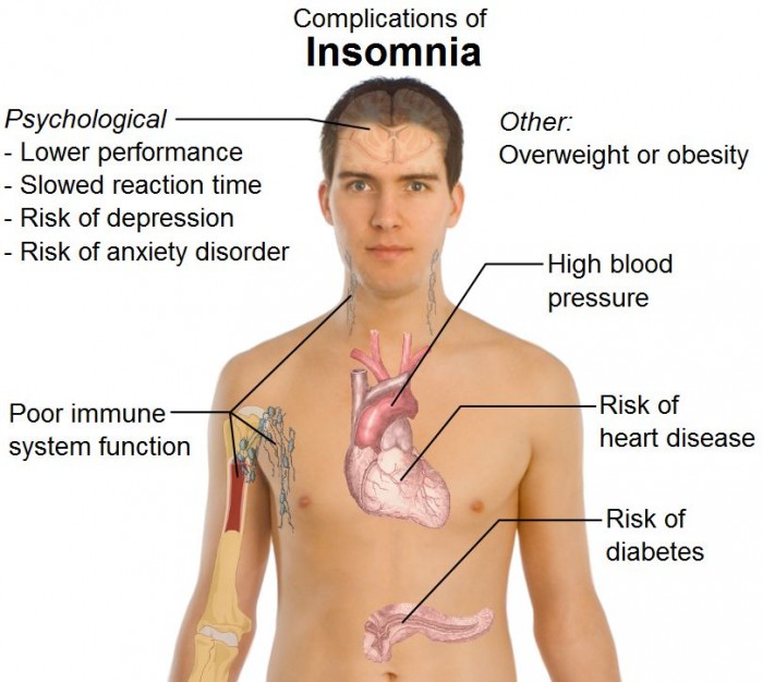 complications of insomnia