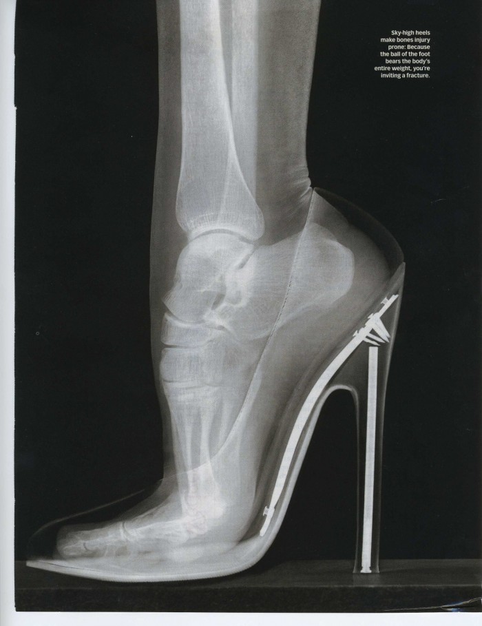What a foot in a heel looks like.jpg