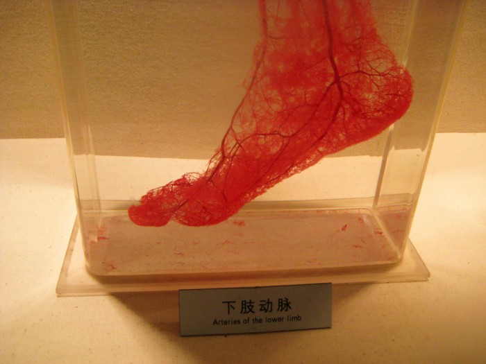 Arteries of the lower limb.jpg