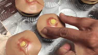 pimple-cupcakes-dr-pimple-popper