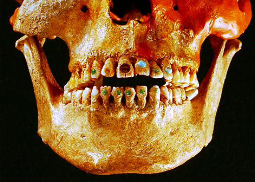 skull-ancient-gemstudded-teeth