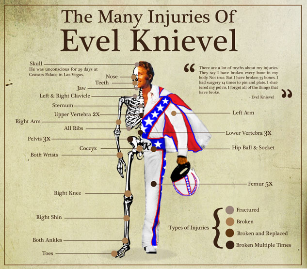 evel-the-many-injuries-of-evel-knievel