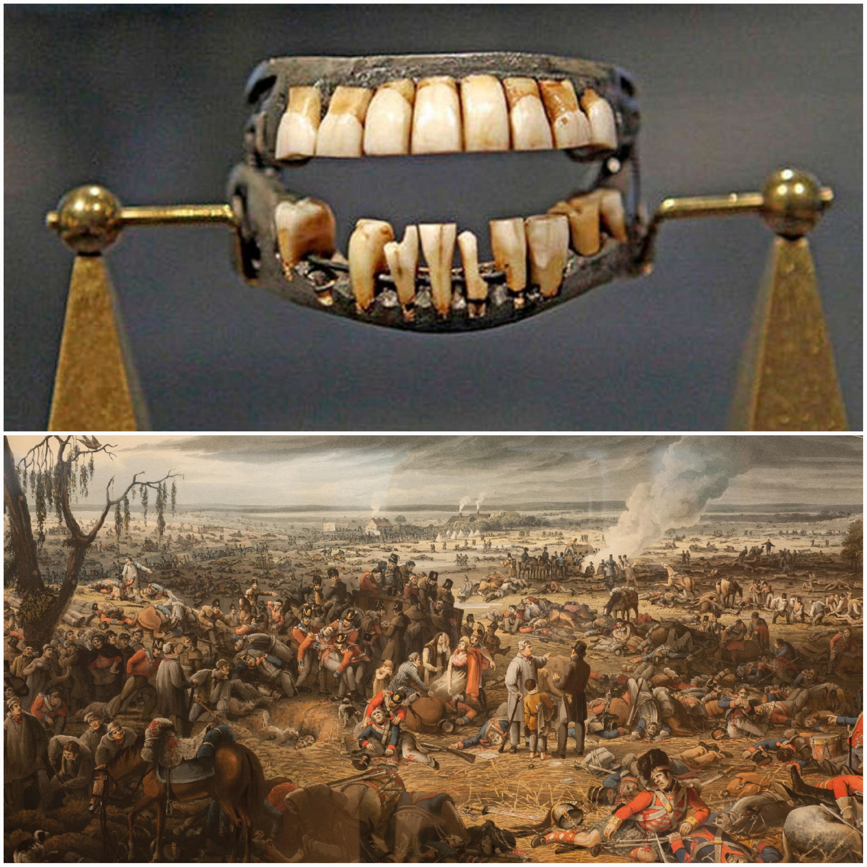 Dentures Were Made From Dead Soldiers Before The 19th Century Places