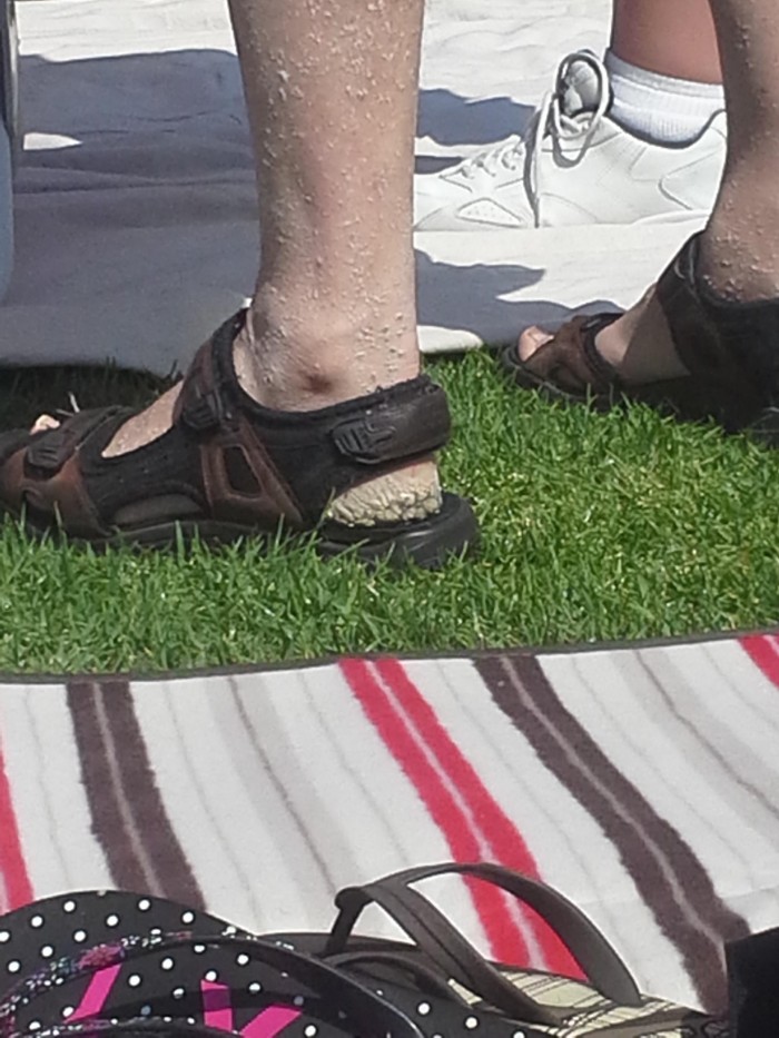 Please-heal-the-heel.jpg (342 KB)