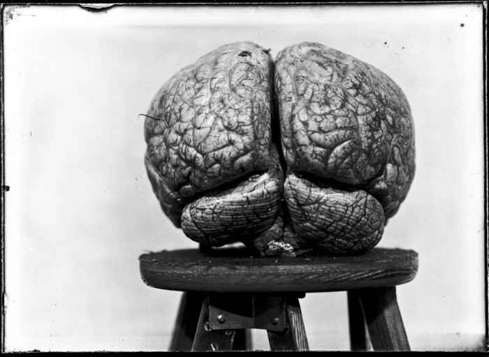 stoolbrain.jpg (107 KB)