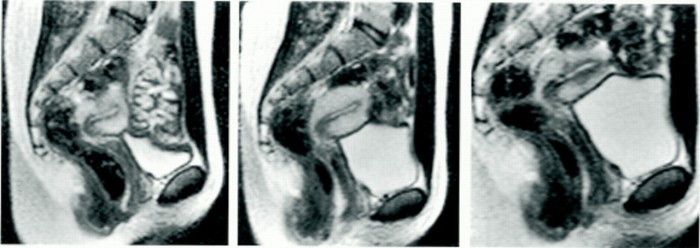 schw4391.f3.jpg (126 KB)