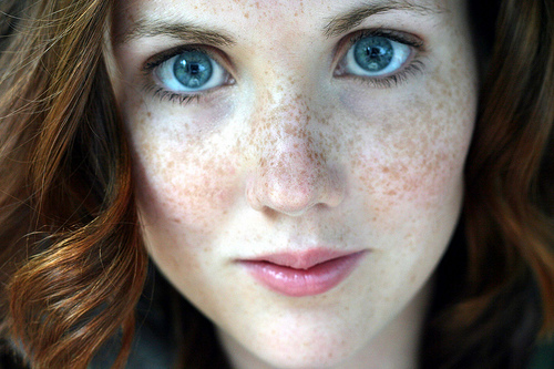 freckles.jpg (112 KB)
